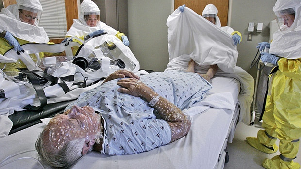 Successfully synthesizing smallpox virus, the risk of a deadly epidemic returning or the development of chemical weapons? Picture 1