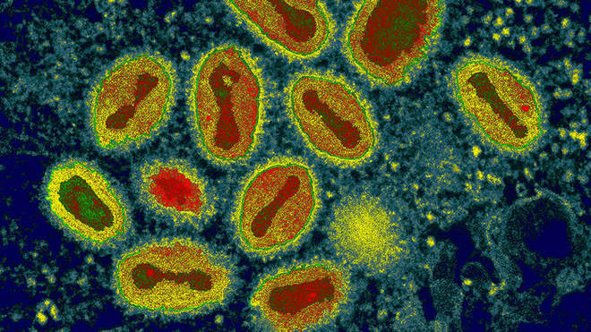 Successfully synthesizing smallpox virus, the risk of a deadly epidemic returning or the development of chemical weapons? Picture 2