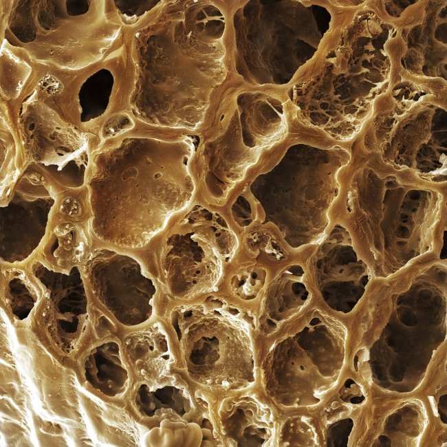 Super beautiful photos of everyday food are viewed through a microscope Picture 6