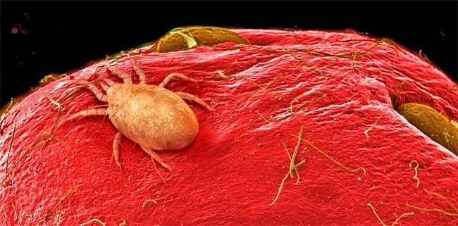 Super beautiful photos of everyday food are viewed through a microscope Picture 8