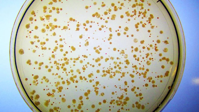 Synthetic enzymes can be catalysts for artificial life Picture 1
