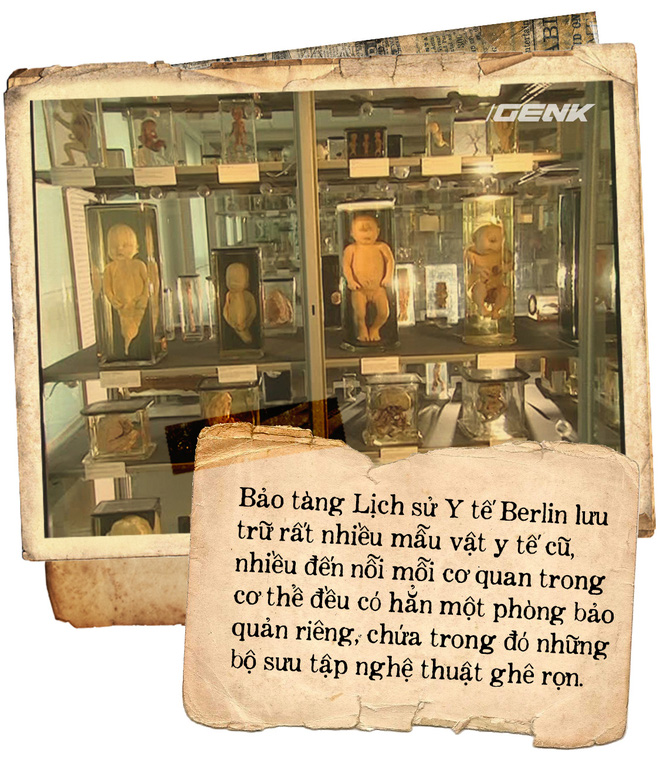 The basement is filled with lungs in Berlin and the telescope looks into the past Picture 1