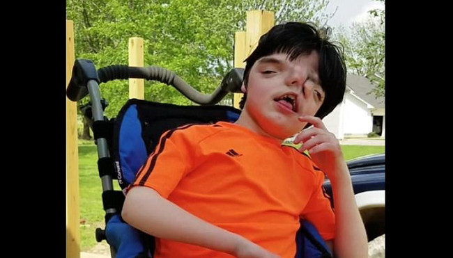 The boy has 'two faces', having won life to celebrate his 13th birthday Picture 1