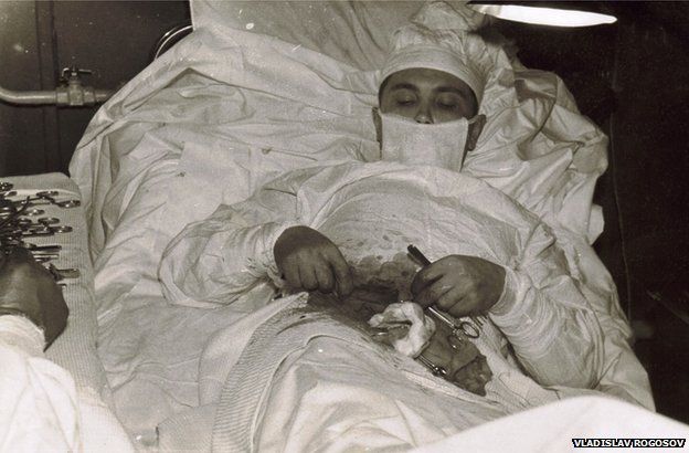 The doctor had his own appendix surgery between Antarctica, the historic operation that made the whole world admire Picture 2