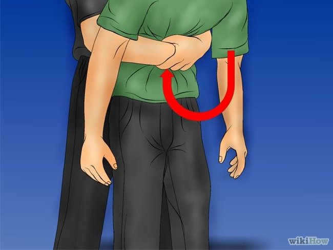 The first aid procedure Heimlich had when he got a heterozygous object Picture 6