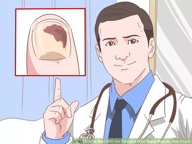 The first aid steps in time when the hand jammed into the door gap Picture 11