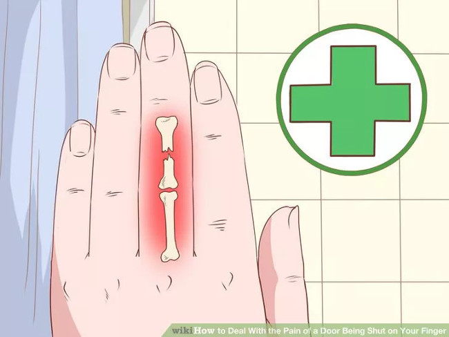 The first aid steps in time when the hand jammed into the door gap Picture 12