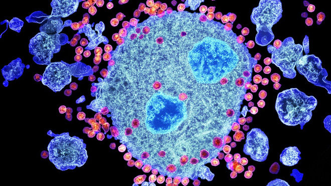 The good news: finding antibodies can kill 99% of the HIV virus strain Picture 2