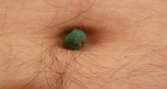 The 'horrifying' facts about the navel startle you Picture 3