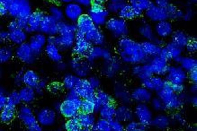The human brain's small biological model reveals the effects of hallucinations Picture 1