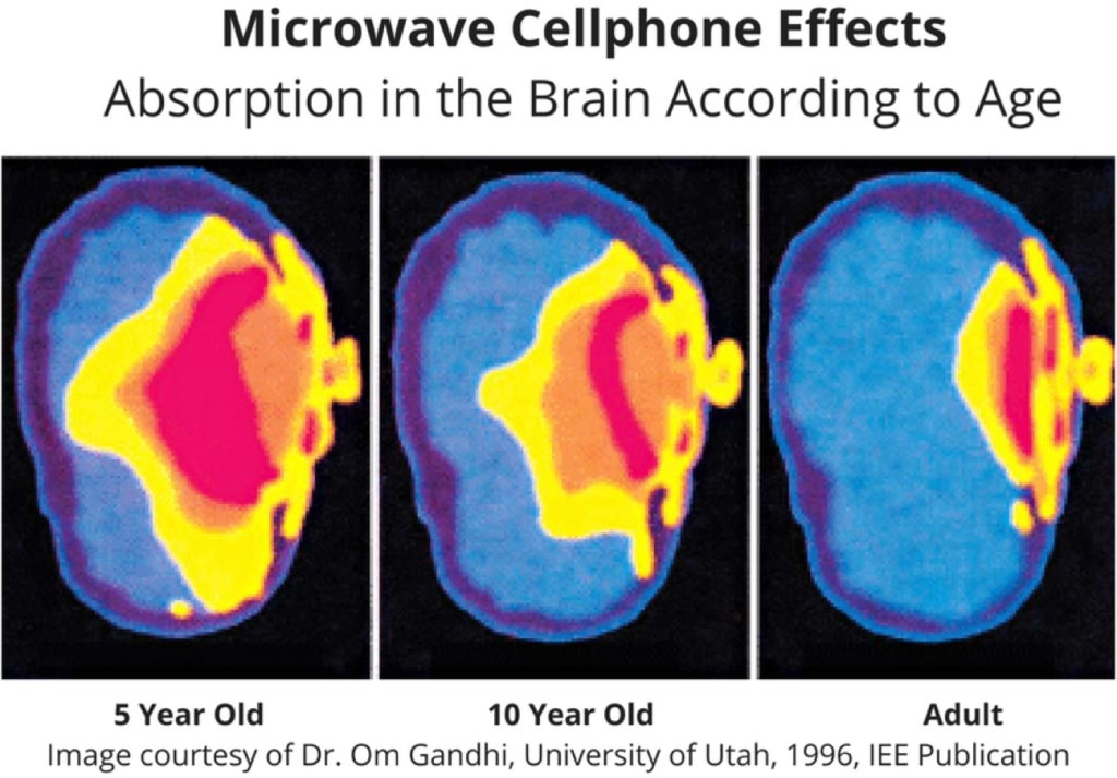 The impact of mobile phone waves on human bodies Picture 2