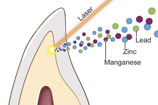 The link between autism and toxic lead levels found in young teeth Picture 1