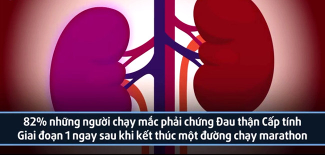 The problems you may encounter if you run a lot Picture 3