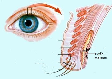 The reason why the eyes wake up every morning and full of rust will surely surprise you Picture 1