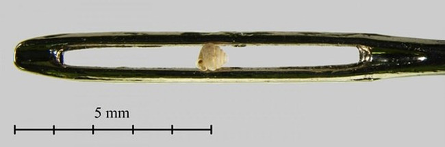 The slug race - the strange slow-motion race in human history Picture 4