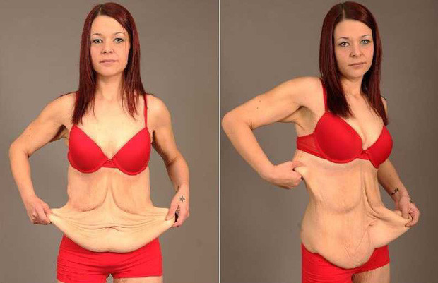 The terrible consequences of your body suddenly lose weight Picture 3