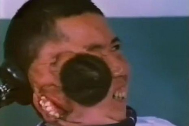 The unbelievable double-face cases in history Picture 3