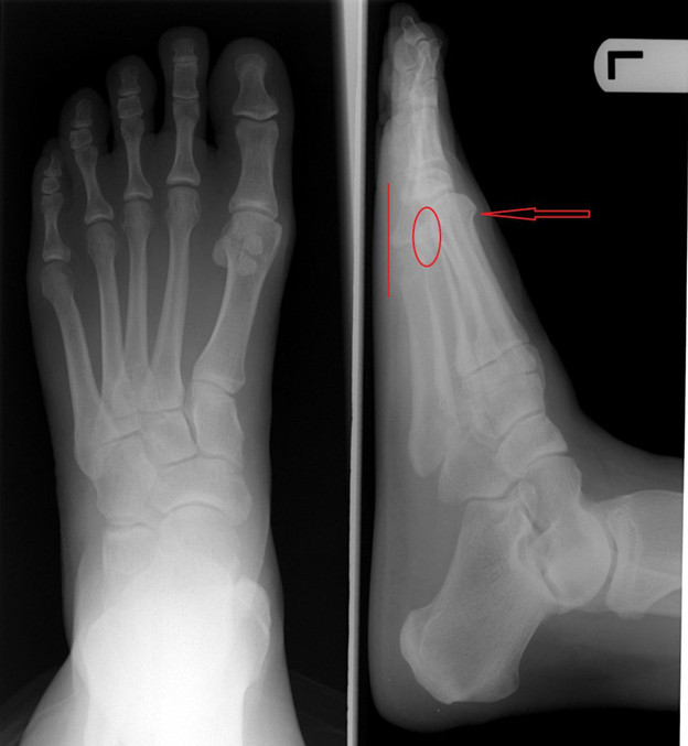 The unexpected truth about the forefinger was longer than the big toe Picture 2