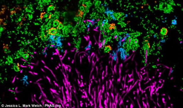 The world of microbes shimmering and fantasy on your teeth Picture 7