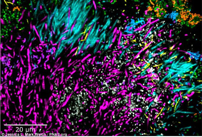 The world of microbes shimmering and fantasy on your teeth Picture 8