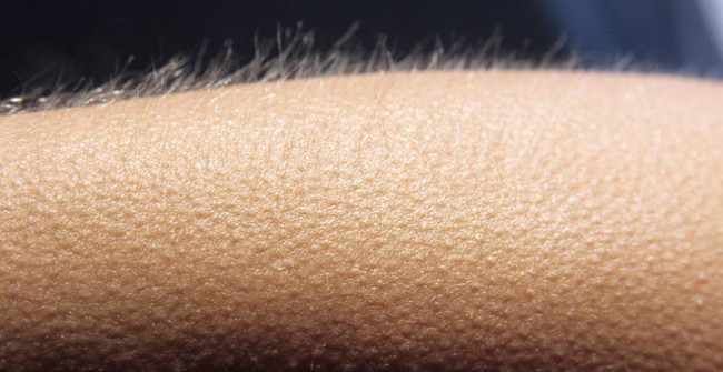 This is the only part of the body that never 'goosebumps'. Picture 1