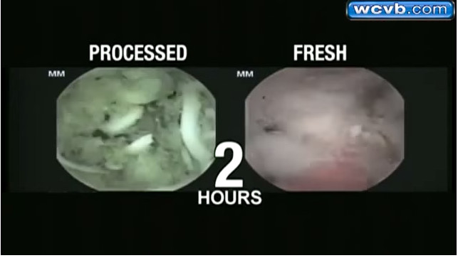 This is what happens in the stomach when you eat shrimp noodles Picture 2