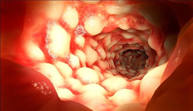 Top 10 'disorder' diseases are stigmatized in the world today Picture 6