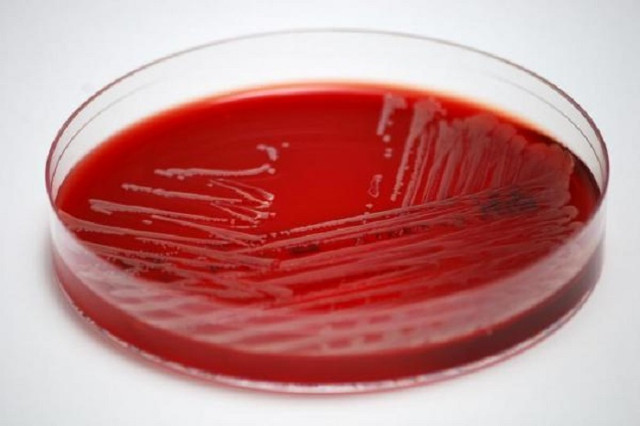 Using statins can reduce the risk of dangerous blood infections Picture 1