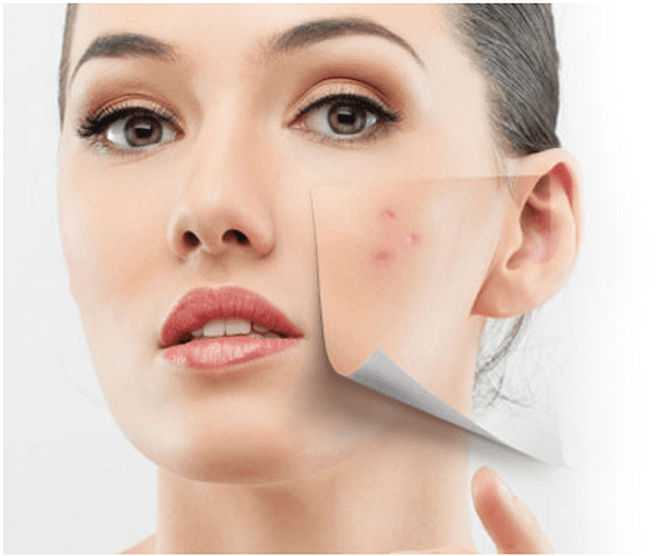 What effect does Vitamin A have? Which foods are Vitamin A? Picture 3