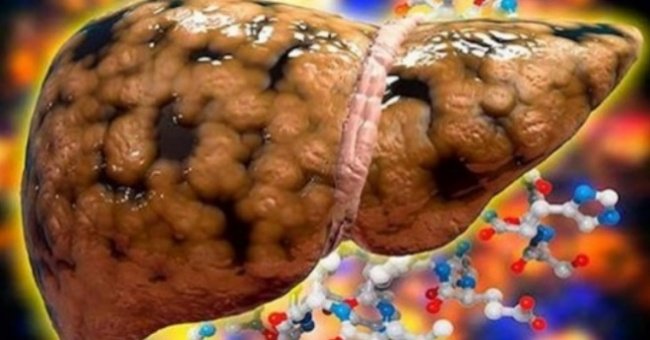 What happens to the body when drinking lemon juice every day? Picture 3