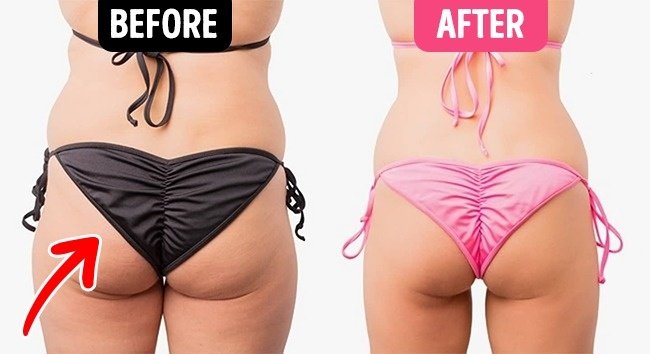 What happens to your body when eating 2 eggs a day? Picture 6