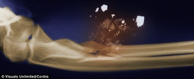 What horrible thing happens when the body is hit by a bullet? Picture 4