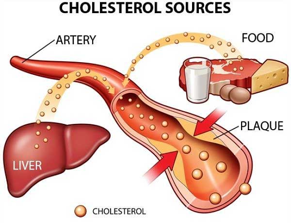 What is cholesterol? Distinguish good cholesterol and bad cholesterol in the body Picture 2