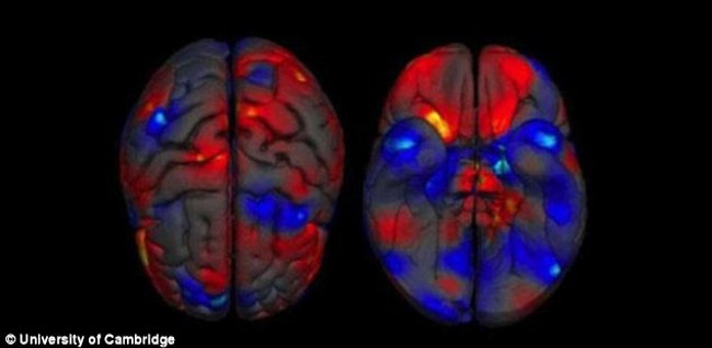 What is the difference between the brain of men and women? Picture 2