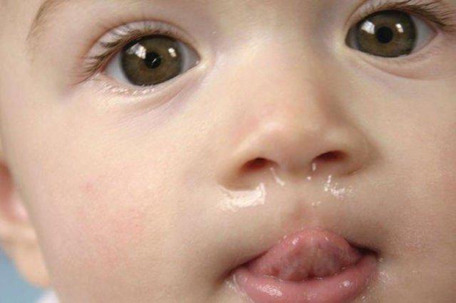 What is the need to pay attention to infants and young children 's nose? Picture 3