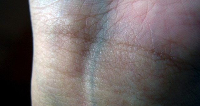 Why are human veins green while blood is red? Picture 1