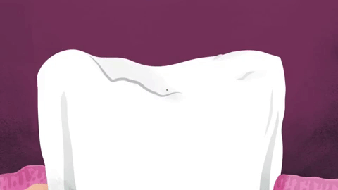 Picture 4 of Why are our teeth deep?