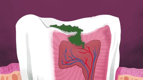 Picture 6 of Why are our teeth deep?