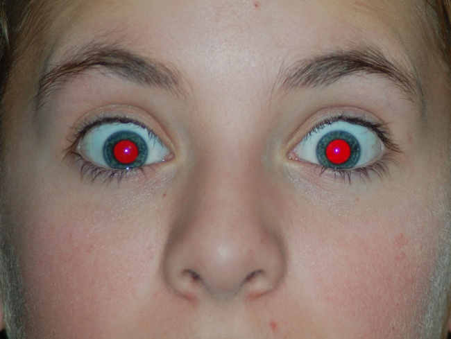 Why does it take 'red' when taking photos of your eyes that look like 'vampires'? Picture 2