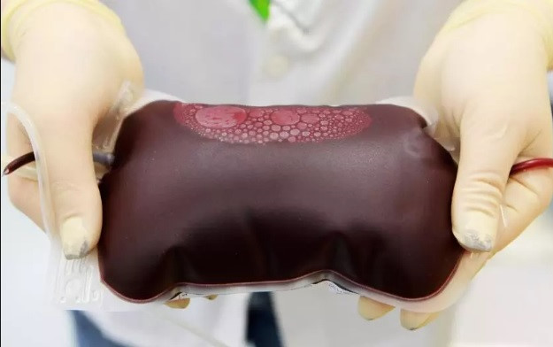 Why is AB the rarest blood group in the world? Picture 3