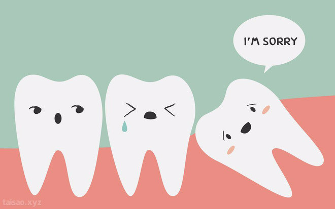 Why is it so stupid and painful that they're still called wisdom teeth? Picture 2