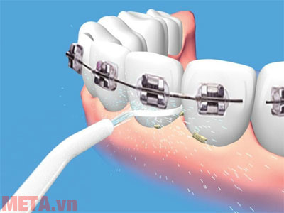Why is water swab is an increasingly popular oral care product? Picture 1