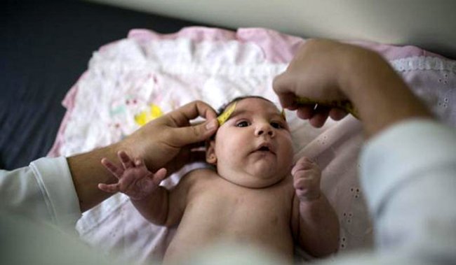 Will Zika virus treat brain cancer? Picture 2