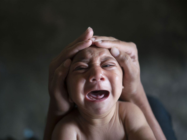 Zika will no longer be scary if this research succeeds Picture 1
