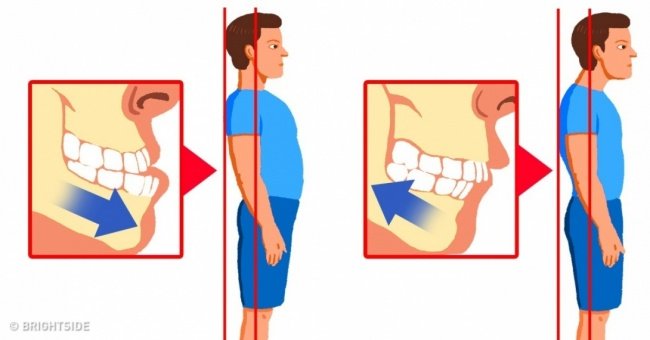 10 Simple Exercises That Help Improve Posture at Home