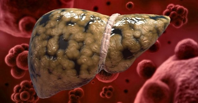 10 Very Good Foods for the Liver That You Should Not Ignore