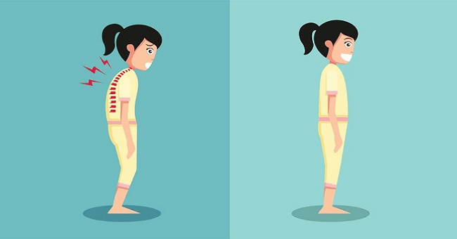 3 Minutes of Exercise Every Day to Keep Your Posture Straight