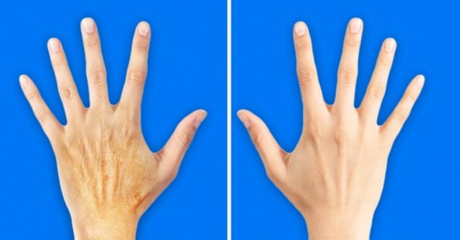 5 Bad Habits Make Your Hands Older Than Your Face to 10 Years Old