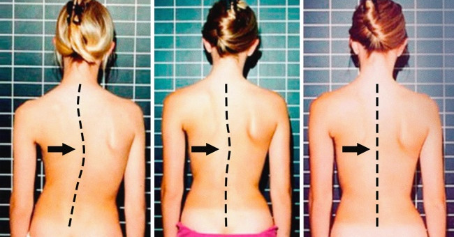 7 Healthy Spine Protection Exercises for You