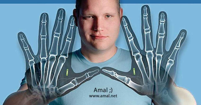 7 People Have Hacked Their Own Bodies to Have the Same Power